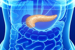 2019 02 01 18 53 5374 Pancreas New 400