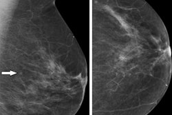 2022 09 14 15 43 0066 2022 09 13 Radiology Radiologist Radiographer Mammo 400