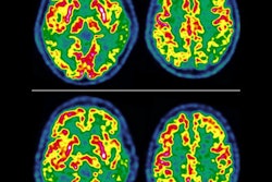 2022 09 17 16 08 3444 2022 09 15 Ultralow Dose Fdg 400