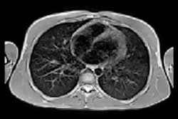 2022 09 21 15 18 2472 2022 09 21 Mri Kids Long Covid C 400