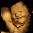 2022 09 21 21 28 7101 2022 09 21 Durham U Ultrasound Fetus Laugh 20220921214916