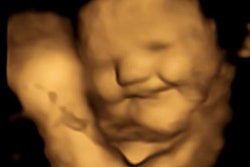 2022 09 21 21 28 7101 2022 09 21 Durham U Ultrasound Fetus Laugh 20220921214916