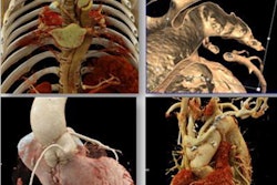 2022 09 30 20 52 1221 2022 09 30 Seram Cardiac Images 20220930204001
