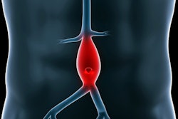 2021 10 13 17 22 0487 Abdominal Aneurysm 400