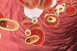 2022 10 04 16 41 3847 Nanoparticle Blood 400