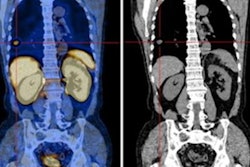 2022 10 04 17 49 1569 2022 09 28 Spect Prostate Cancer 20221004172214