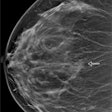 2022 10 05 23 20 9381 2022 10 03 Radiology Dbt Breast Density 20221005231945