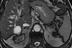 2022 10 10 22 52 5625 2022 10 11 Missed Pancreatic Tumor Fig1 400
