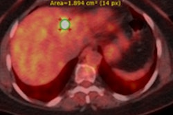 2022 10 11 21 49 4449 2022 10 12 Pet Ct Of Non Small Cell Lung Cancer 400