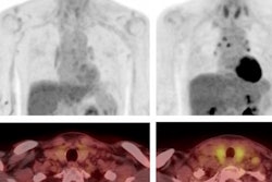 2022 10 13 22 01 8325 2022 10 14 Hypothyroidism 400