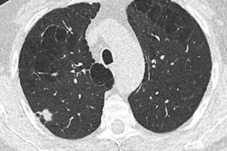 2022 10 14 19 00 7093 2022 10 17 Lung Caramella 1 400
