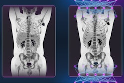 2022 10 17 16 27 0747 2022 10 17 Omni Legend Clinical Ge Healthcare 400