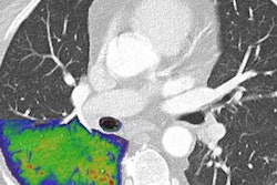 2022 09 26 20 11 1920 2022 09 27 Lung Covid Phonton Counting 20220926203021