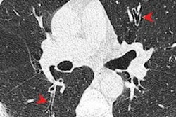 2022 11 17 22 22 5010 2022 11 15 Radiology Ct Marijuana Effects 20221117223650