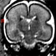 2022 11 22 16 41 5855 2022 11 24 Rsna Pr Baby 400