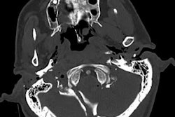 2022 11 22 23 23 5144 2022 11 Boyce Traumatic Crush Injury Abc 20221123004114