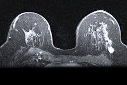 2019 07 16 19 23 2822 Mri Breast 400