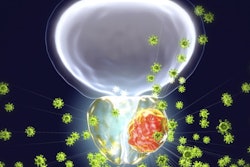 2021 02 12 16 33 4471 3 D Prostate Cancer Viral 400