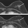 2022 12 05 21 47 6813 2022 06 14 Rsna Abbreviated Breast Mri 400