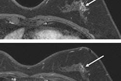 2022 12 05 21 47 6813 2022 06 14 Rsna Abbreviated Breast Mri 400