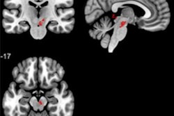 2022 12 07 00 23 5775 2022 11 21 Brain Abnormalities 400