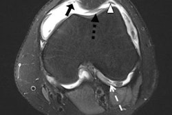 2022 12 07 16 28 3779 2022 12 06 Er Vo Chieu Knee Arthritis 20221207163118