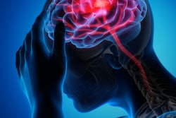 2021 08 03 16 02 9021 Brain Stroke 400