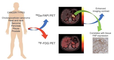Graphical abstract. Image courtesy of the Journal of Nuclear Medicine.