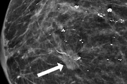 2023 01 11 19 49 0198 2023 01 10 Radiology Dcis 20230111194634