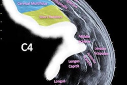 2023 01 14 01 32 6527 2023 01 11 Panoramic Ultrasound 400