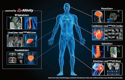 AI automatic positioning techniques allow staff to concentrate on other, more rewarding tasks, such as postprocessing.