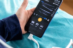 2023 01 23 18 28 0951 Handheld Ultrasound 400
