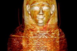 2023 01 24 01 58 5834 2023 01 24 Golden Mummy 3 D Ct Criss Cross Wrappings 20230124012427