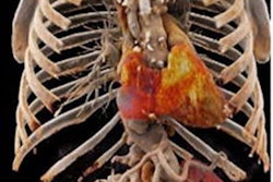 2023 01 30 17 54 2573 2023 01 26 Rad Cardiothor Imag Higashigaito Figure5 20230130173624