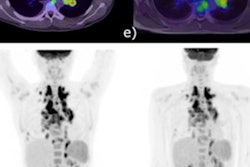 2023 02 03 17 22 0757 2023 02 01 Pet Lymphoma 20230203170408