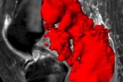 2023 02 07 02 55 9651 2023 02 07 Mri Insider Fig8 20230207022037