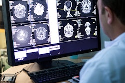 2023 02 22 21 49 3070 Radiologist Brain Scans Monitor 400
