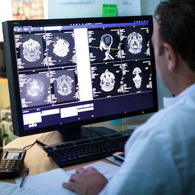 2023 02 22 21 49 3070 Radiologist Brain Scans Monitor 400