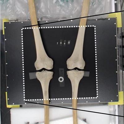 2023 02 25 01 34 2212 2023 02 06 Knee X Ray Original 20230225012955
