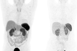 2023 02 25 01 57 7546 2023 02 24 Sstr Tracer Uptake 20230225011424