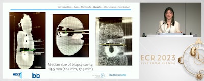 Dr. Alma Hoxhaj from Radbound University Medical Center in the Netherlands presents her team's results showing the promise of contrast-enhanced CBCT in breast biopsy settings. The team used phantom models for the study.