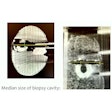 2023 03 02 16 22 8490 2023 03 01 Ecr Cbct Breast Biopsy 400