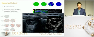 Dr. Davide Negroni presents findings from research he led on combining SMI with elastosonography for diagnosing thyroid lesions. While the method's diagnostic performance was lower than ACR TI-RADS when used in a heterogeneous, it may yield some potential.