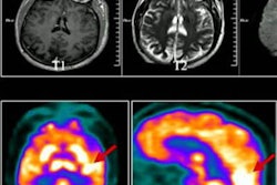 2023 03 03 03 02 8240 2023 03 03 Pet Ct Covid 20230303032835