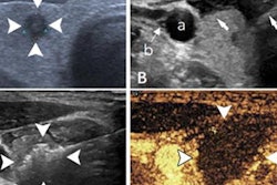 2023 03 08 19 47 6106 2023 03 07 Mwa Thyroid V2 20230308195712