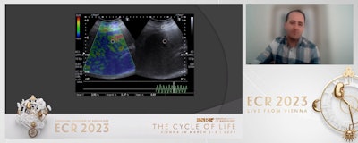 Dr. Yusuf Aksu from Necip Fazıl City Hospital in Kahramanmaras, Turkey presents findings at ECR 2023 that demonstrate how strain elastography shows higher liver stiffness in patients who have recovered from long COVID-19.