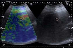 2023 03 10 16 19 5213 2023 03 05 Ecr Aksu 400