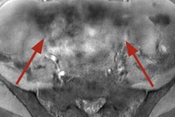 2023 03 21 01 13 4451 2023 03 21 Mri Artifacts Fig 6 20230321012215