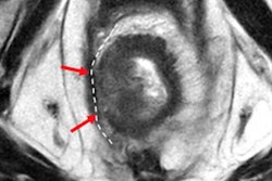 2023 03 21 23 41 3605 2023 03 22 Mri Insider Fig5 20230322032427