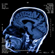 2020 07 09 15 10 1888 Mri Head 400